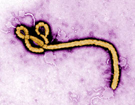 This image from the Centers for Disease Control and Prevention shows the Ebola virus.